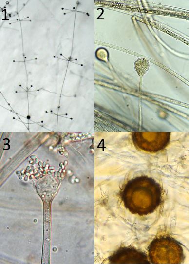 Figure 1) Typical verticillate appearance of the sporangiophore and sporangia in A. caerulea (Benny s386). Figure 2) A typical Absidia sporangium with the septum well below the sporangium on the sporangiophore (Benny s296). Figure 3) A sporangium after spore release showing sporangiophore septum and a portion of the columella (Benny s274). Figure 4) A zygospore of Absidia showing the appendages arising from both suspensors (RSA2401). Images by Gerald Benny.
