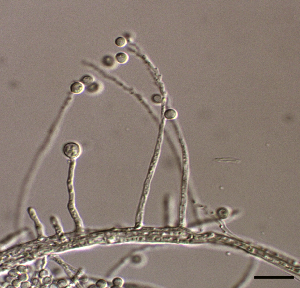Photo of Acidothrix acidophila CBS 136259 v1.0