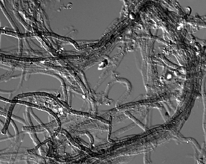 A. richmondensis visualized with DIC light microscopy. Field sample from Richmond Mine at Iron Mountain, CA. Picture by Chris Miller