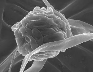 Scanning Electron Microscope (SEM) image of conidophore and hyphae from Acremonium strictum isolate DS1bioAY4a.