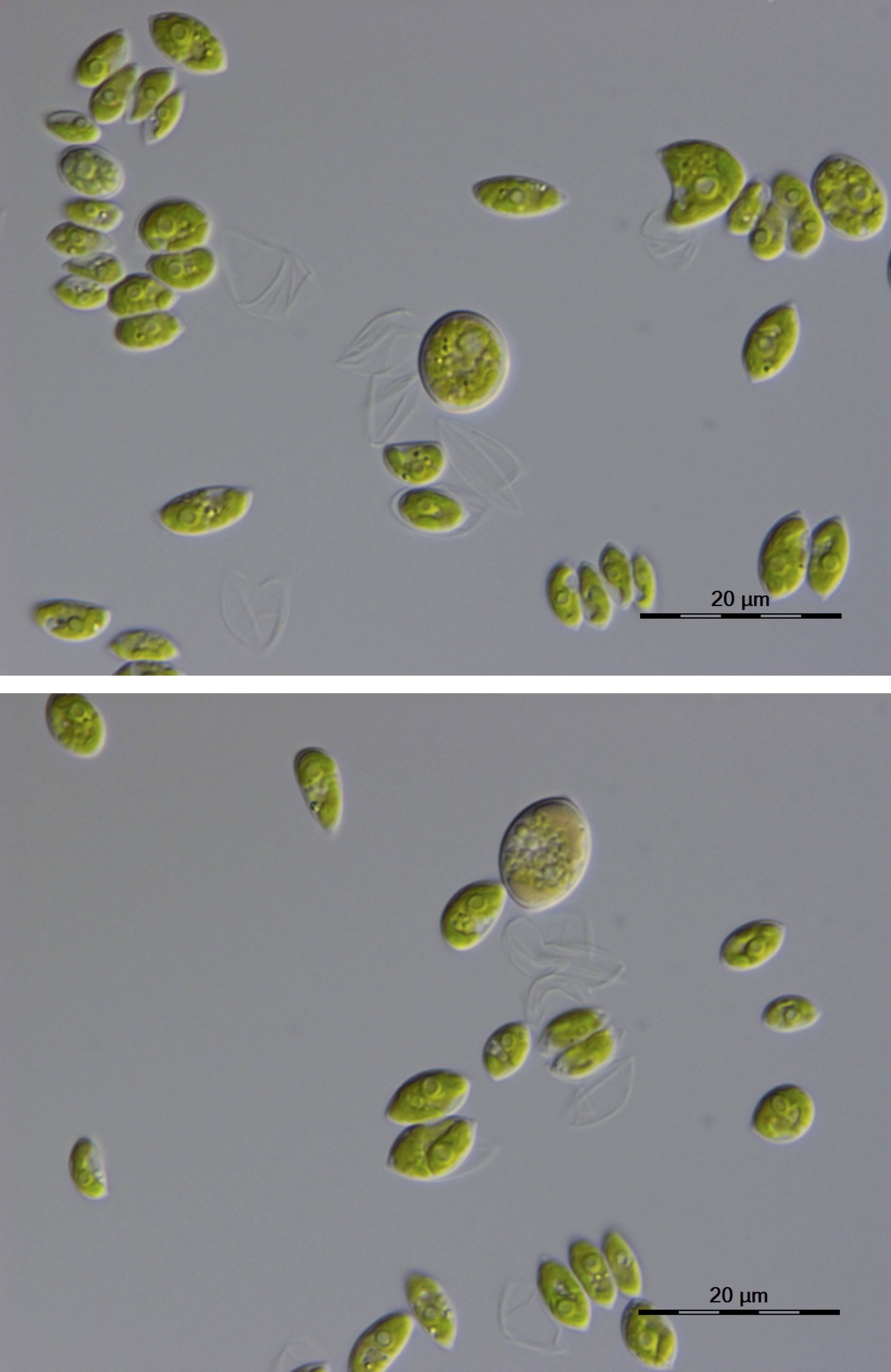 Micrographs of Scenedesmus obliquus SAG 2326. Credit: Tatyana Darienko, Sammlung von Algenkulturen der Universität Göttingen (SAG)