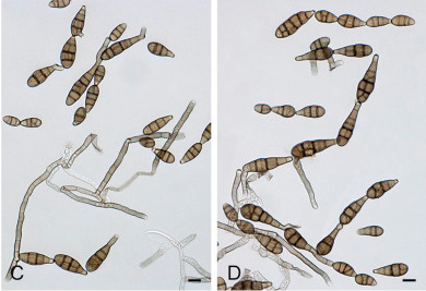 Conidia and conidiophores of Alternaria arborescens