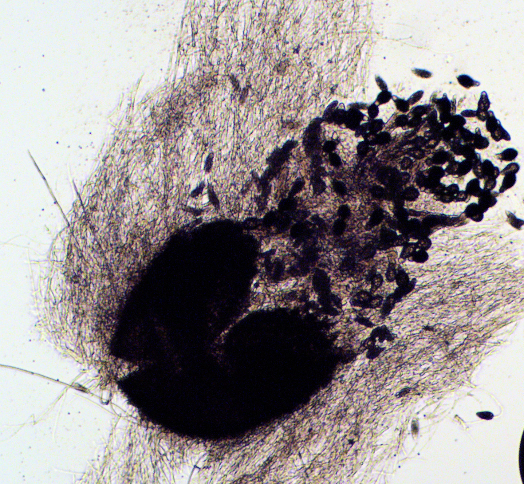 Apiosordaria backusii. [Image Credit: Pr. Philippe Silar, Université Paris Cité.]