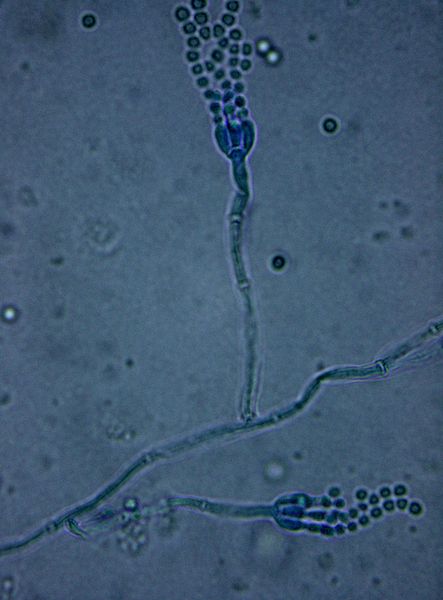 Penicillium sp. DTU1
