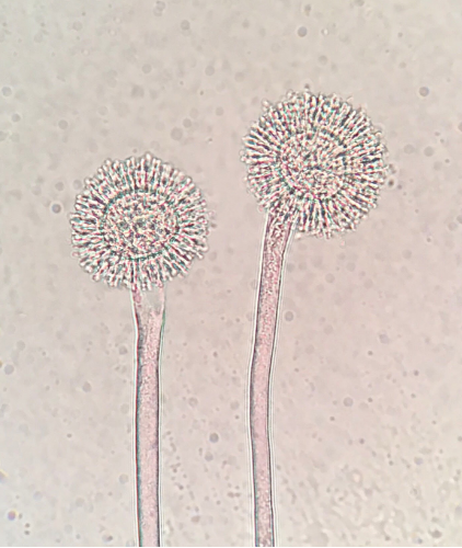 Transmitted light microscopy image of Aspergillus flavus conidiophores at 400x magnification.  Photo taken by Tracy Debenport.