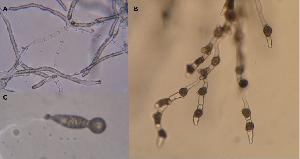 Basidiobolus meristosporus A) Mycelial growth and septate hyphae, B) Zygospores, and C) Conidiophore. Photos by Andrii Gryganskyi
