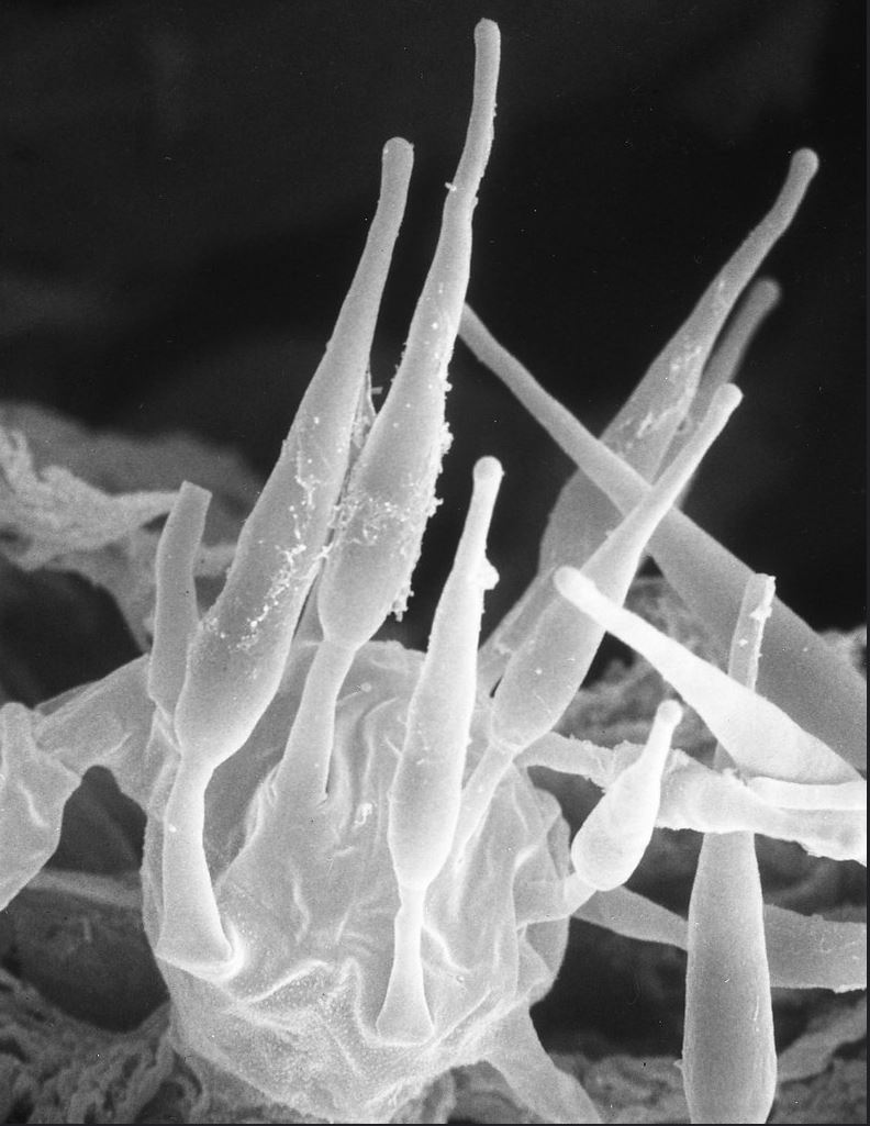 Elongated microspores of Basidiobolus microsporus. Image by Kerry O'Donnell.