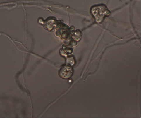 Chlamydospore of Bisporella sp. growing on oatmeal agar. Photo credits: J. A. Rojas.