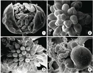 Fig 1) B. trispora sporangia with many sporangiospores. Fig 2-3)
sporangioles with only a few or one sporangiospore. Fig 4)
zygospores on apposed suspensors. Images by Kerry O'Donnell