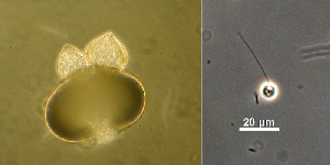 Photo of Blyttiomyces helicus single-cell v1.0