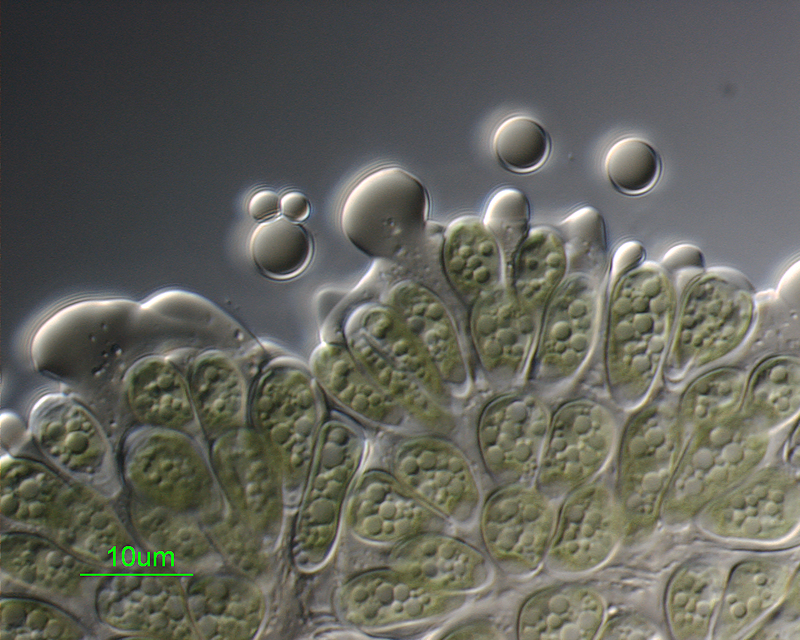 Micrograph of Botryococcus braunii