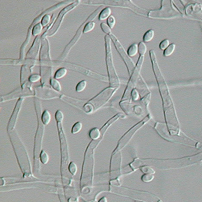 Paecilomyces variotii from water-damaged hardwood flooring grown in slide culture on Modified Leonian's agar and photographed in Nomarski Differential Interference Contrast microscopy.