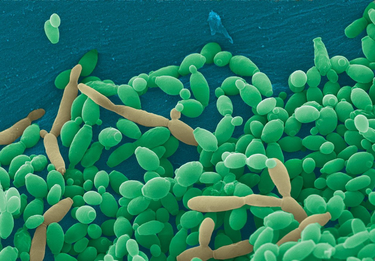 Pseudo-colored scanning electron micrograph of Candida tropicalis displaying both yeast and pseudohyphae.