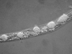 Catenaria anguillulae isolate parasitizing a nematode. Photo credit: Dr W. Wallace Martin, Randolph-Macon College 