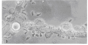 Photo of Caulochytrium protostelioides ATCC 52028 single-cell v1.0