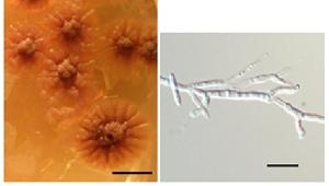 Ceraceosorus guamensis sp. nov. culture on PDA (left) and cell morphology from yeast-malt broth (right)