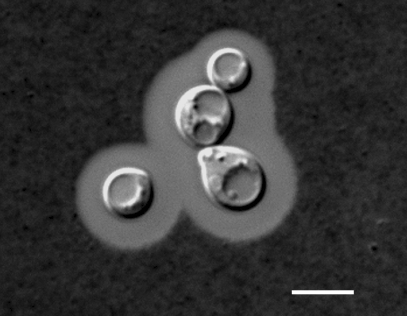 The image of Cryptococcus gattii