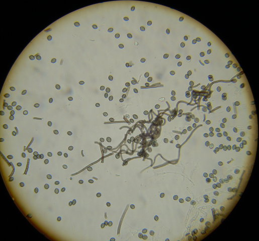 Chaetomium ascospores. 