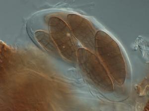 Clathrospora elynae - Ascus with ascospores