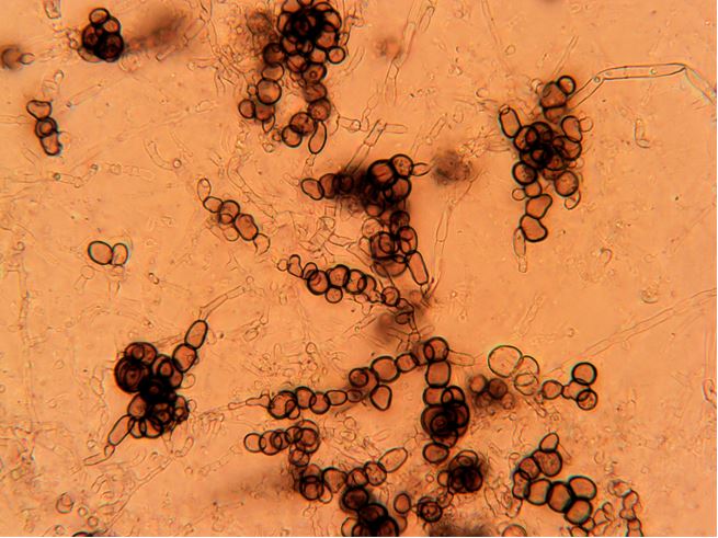 Cladorrhinum microsclerotigenum CBS 290.75 microsclerotes. Photo credit: Philippe Silar.