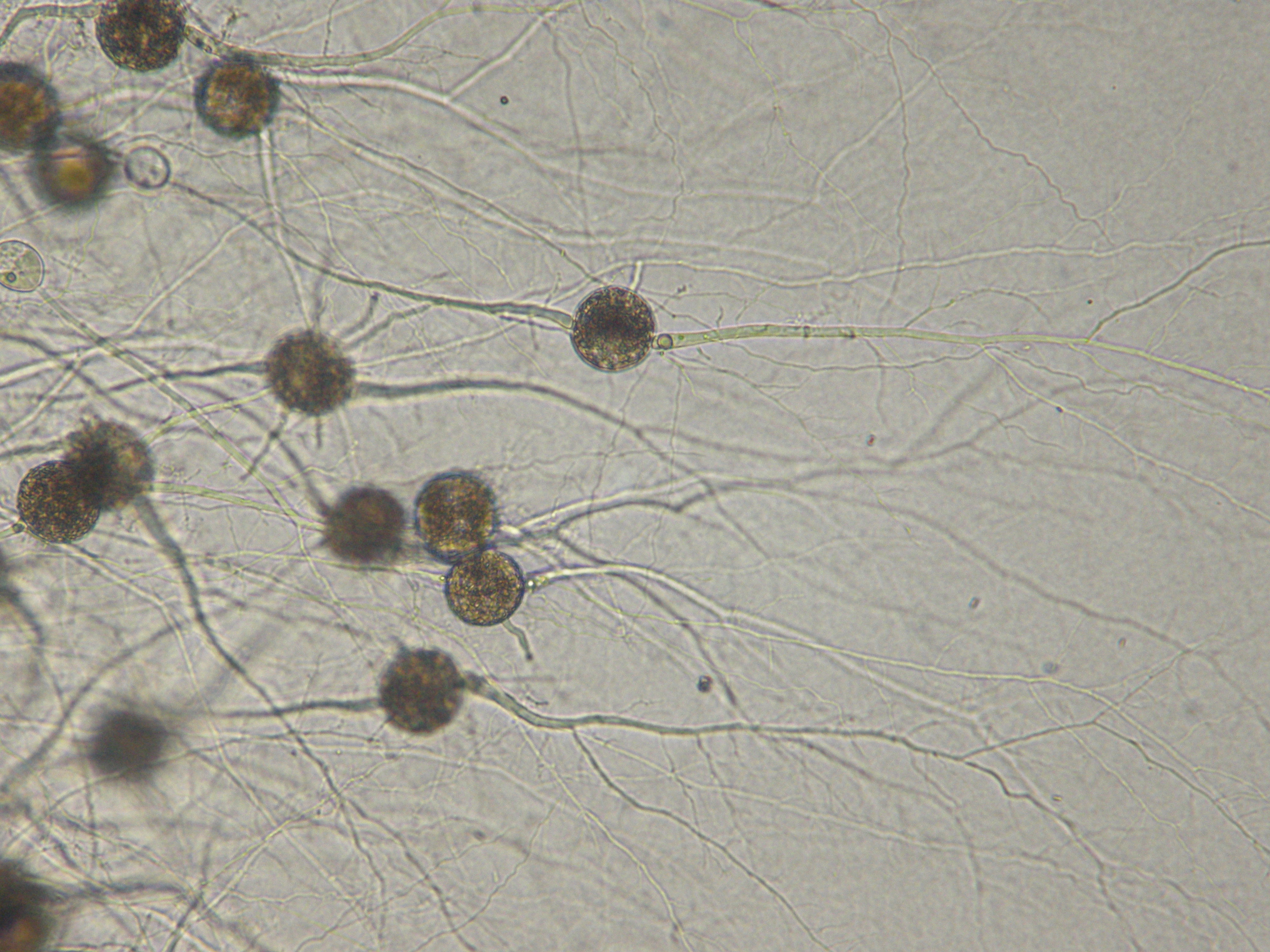 Zoosporangia and thalli of Cladochytrium polystomum (WB228). Photo by Martha Powell.