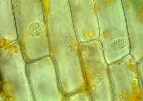 Cladochytrium replicatum JEL0714. Two septate turbinate swellings (center; oriented vertically), definitive structures of Cladochytrium rhizomycelium, in Elodea from original collection. Image provided by Joyce E. Longcore.