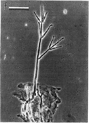 Asexual state of Clonostachys rosea showing a conidiophore with whirled phialdes and conidia (Rossman et al. 1999). 

