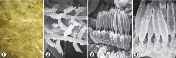 Figs 1-2) Loosely coiled, regularly septate aerial sporophores of C. spiralis. Fig 3) Asexual reproduction is via the production of unispored sporangia that are borne on special lateral branches called sporocladia. Fig 4) Mature striate sporangia. Images by Kerry O'Donnell.