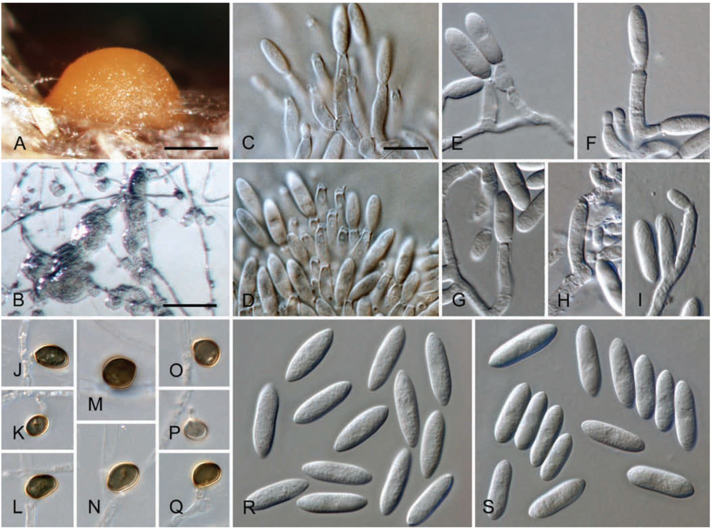 Photo of Colletotrichum acutatum COL14