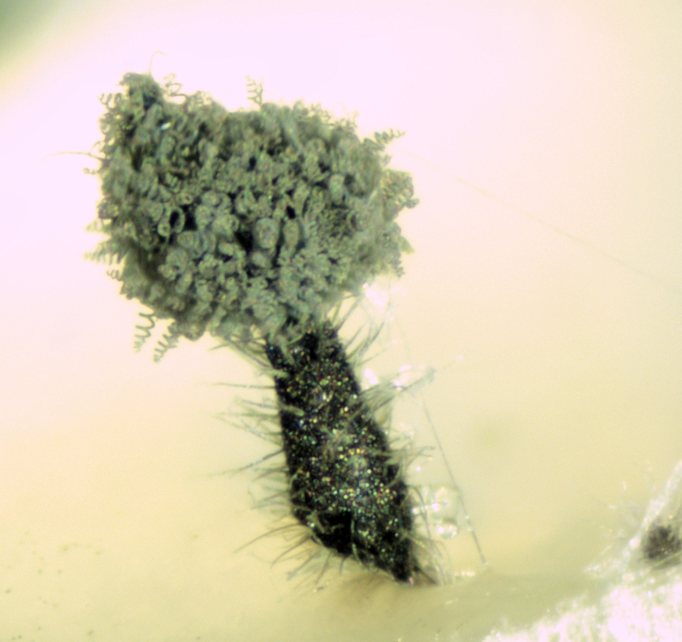 Perithecium of Collariella robusta. [Image Credit: Pr. Philippe Silar, Université Paris Cité.]