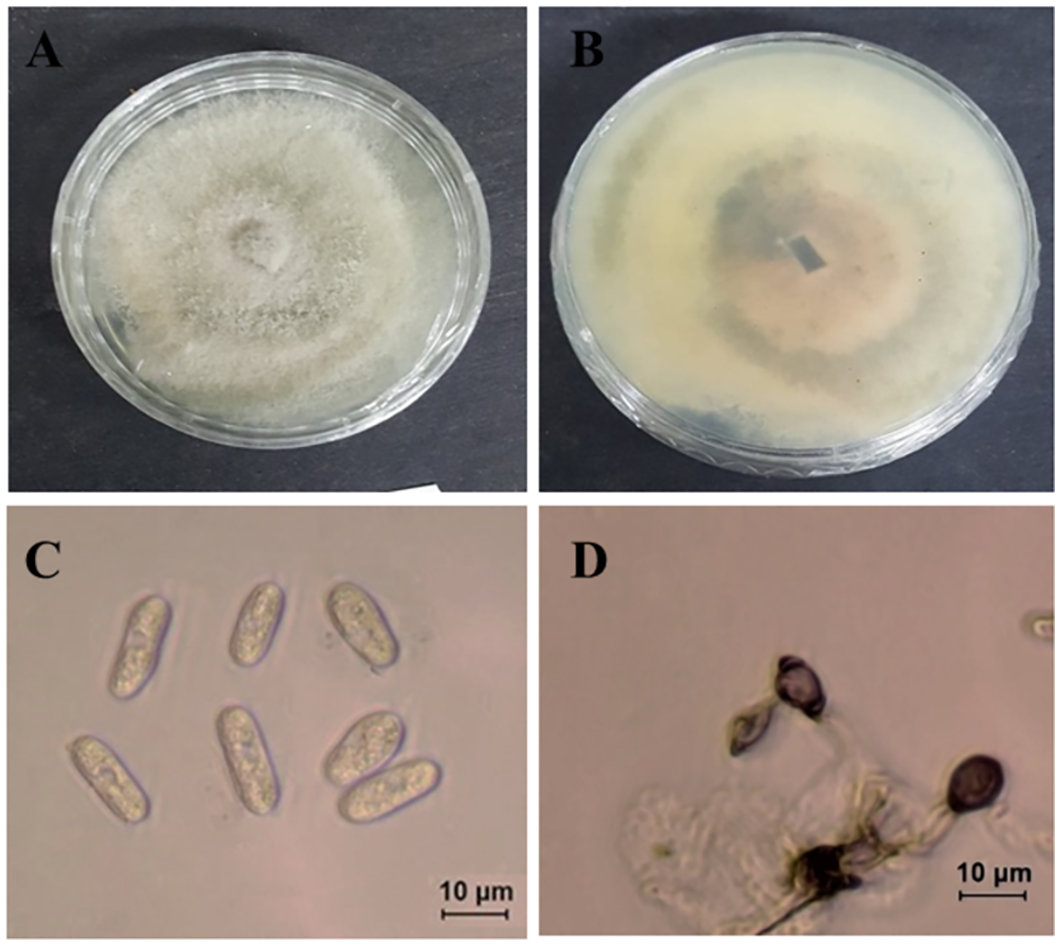 Photo of Colletotrichum sojae LFN0009