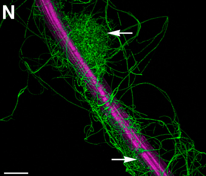 Confocal microscope images of Colletotrichum tofieldiae expressing cytoplasmic GFP (green) and Arabidopsis thaliana expressing PIP2A-mCherry (magenta). Root enmeshed by a network of extraradical hyphae, with melanized microsclerotia developing (arrows).