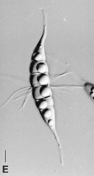 Ascospores of Corollospora maritima. Image from Spatafora, Volkmann-Kohlmeyer and Komlmeyer, 1998.