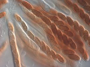 Cucurbitaria berberidis ascospores
