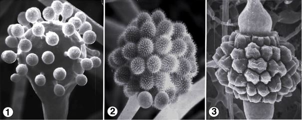 Fig 1)  Pedicellate, unispored sporangia of C. echinulata that typically cover the surface of a terminal fertile vesicle. Fig 2) Sporangiola are covered with elongate spines at maturity. Fig 3) Reddish-brown zygospores between opposed suspensors. Images by Kerry O'Donnell.