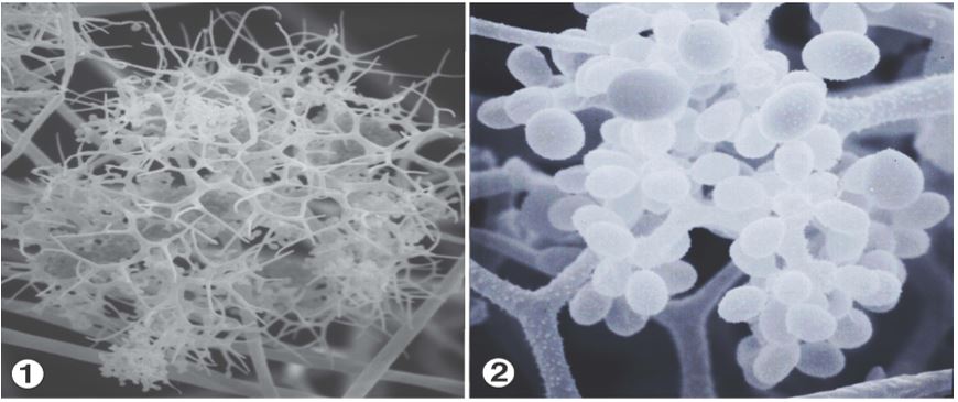 Figures 1 and 2: Sporangiophores that bear unispored sporangiola in terminal heads composed of dichotomously branching fertile hyphae. Images by Kerry O'Donnell