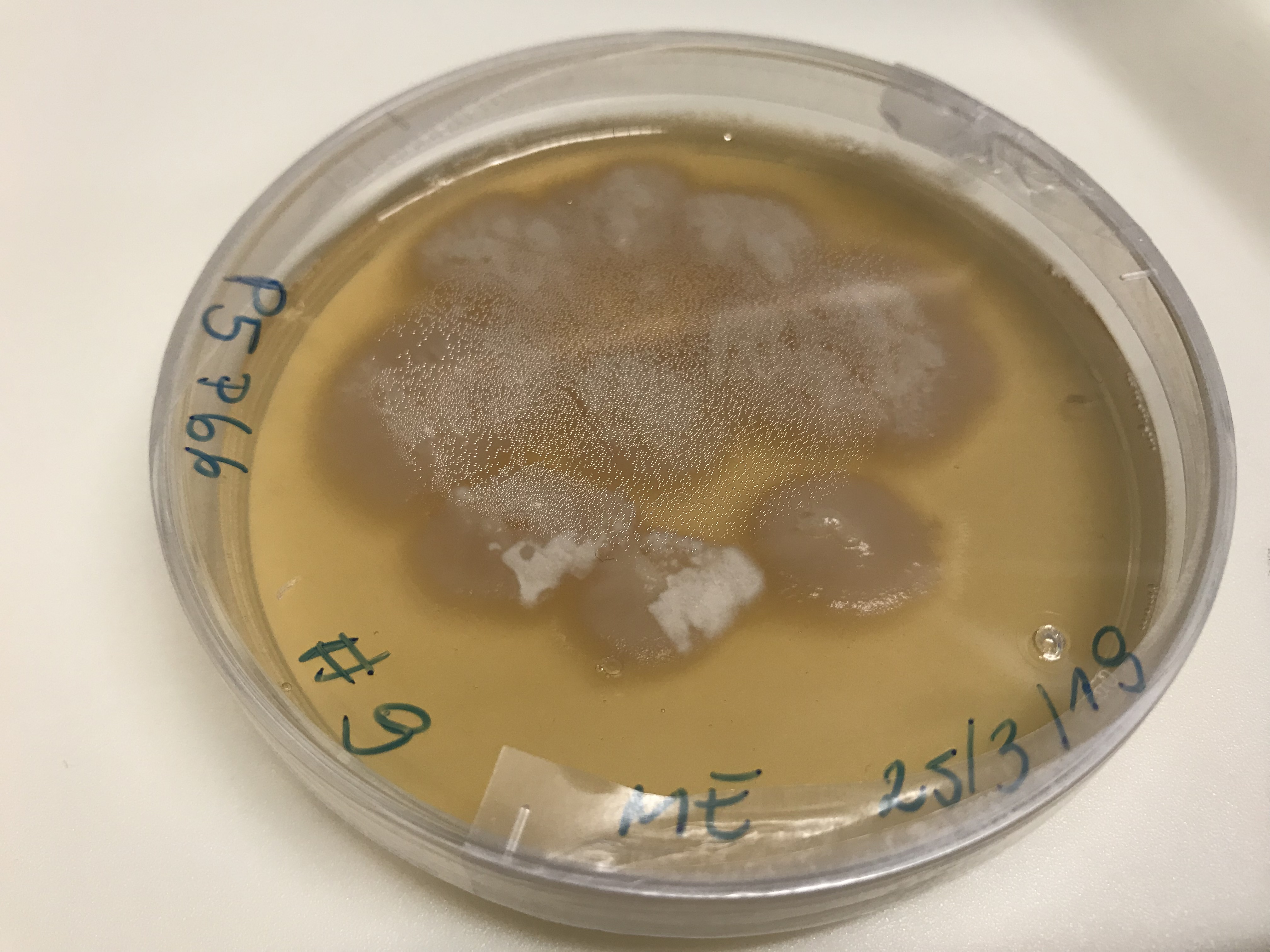 Helotiales isolate P5P66 growing in the lab.