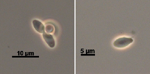Left: clump of three sporangiospores. Right: isolated sporangiospore. (photo credit: Timothy James, University of Michigan)