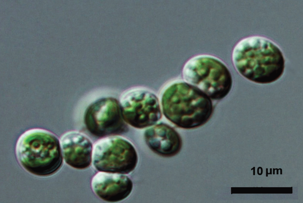 Elliptochloris bilobata [Image credit: By Elena Patova, Irina Novakovskaya, Evgeniy Gusev & Nikita Martynenko - Patova et al. (2023): <a href="https://www.mdpi.com/1424-2818/15/10/1080" target="-blank">https://www.mdpi.com/1424-2818/15/10/1080</a>, <a href="https://creativecommons.org/licenses/by/4.0" target="_blank">CC BY 4.0</a>, <a href="https://commons.wikimedia.org/w/index.php?curid=142201064" target="_blank">https://commons.wikimedia.org/w/index.php?curid=142201064</a>]