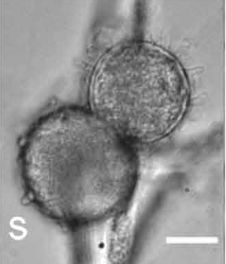 Bluntly spined terminal chlamydospores of Entomortierella echinosphaera CBS 575.75. [Image source: Wagner et al., 2013, <a href="https://www.ncbi.nlm.nih.gov/pmc/articles/PMC3734968/" target="_new">https://www.ncbi.nlm.nih.gov/pmc/articles/PMC3734968/</a>, available under <a href="https://creativecommons.org/licenses/by-nc-nd/3.0/legalcode" target="_new">CC BY-NC-ND 3.0</a>]
