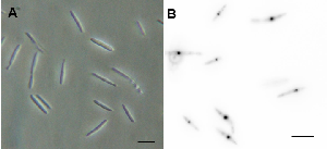 Photo of Exobasidium vaccinii MPITM v1.0