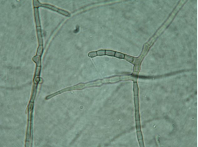 Hyphae of Extremus antarcticus under a light microscope. Image courtesy of Laura Selbmann.