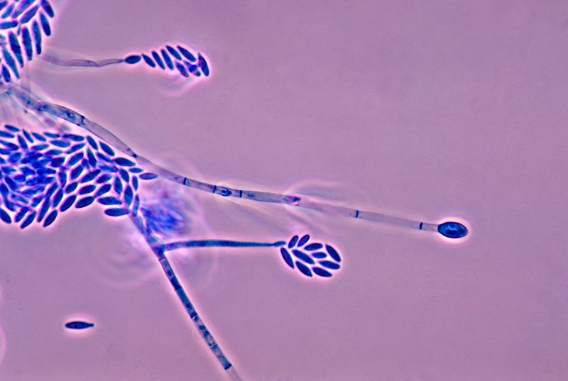Photomicrograph revealing the conidiophores and conidia of the fungus Fusarium verticillioides.