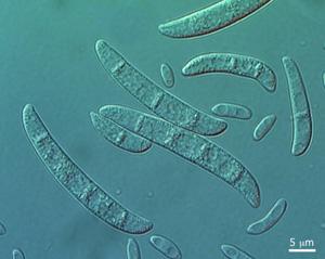 Macroconidia and microconidia of Fusarium vanettenii. Photo by Dr. Dai Tsuchiya.
