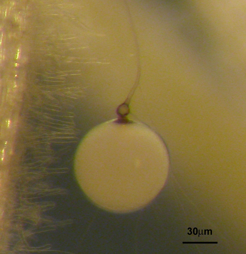 Details of a Gigaspora margarita spore, with subtending hypha. Image credit: Mara Novero