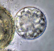 Globomyces pollinis-pini collected from Regatas (artificial freshwater) Lake, Palermo Woods, Buenos Aires City, Argentina. Image by Carlos G. Vélez