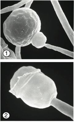 Figure 1) Distinct subsporangial swelling termed (apophysis) of Gongronella butleri. 
Figure 2) Hemispherical columella. 
Images by Kerrie O'Donnell