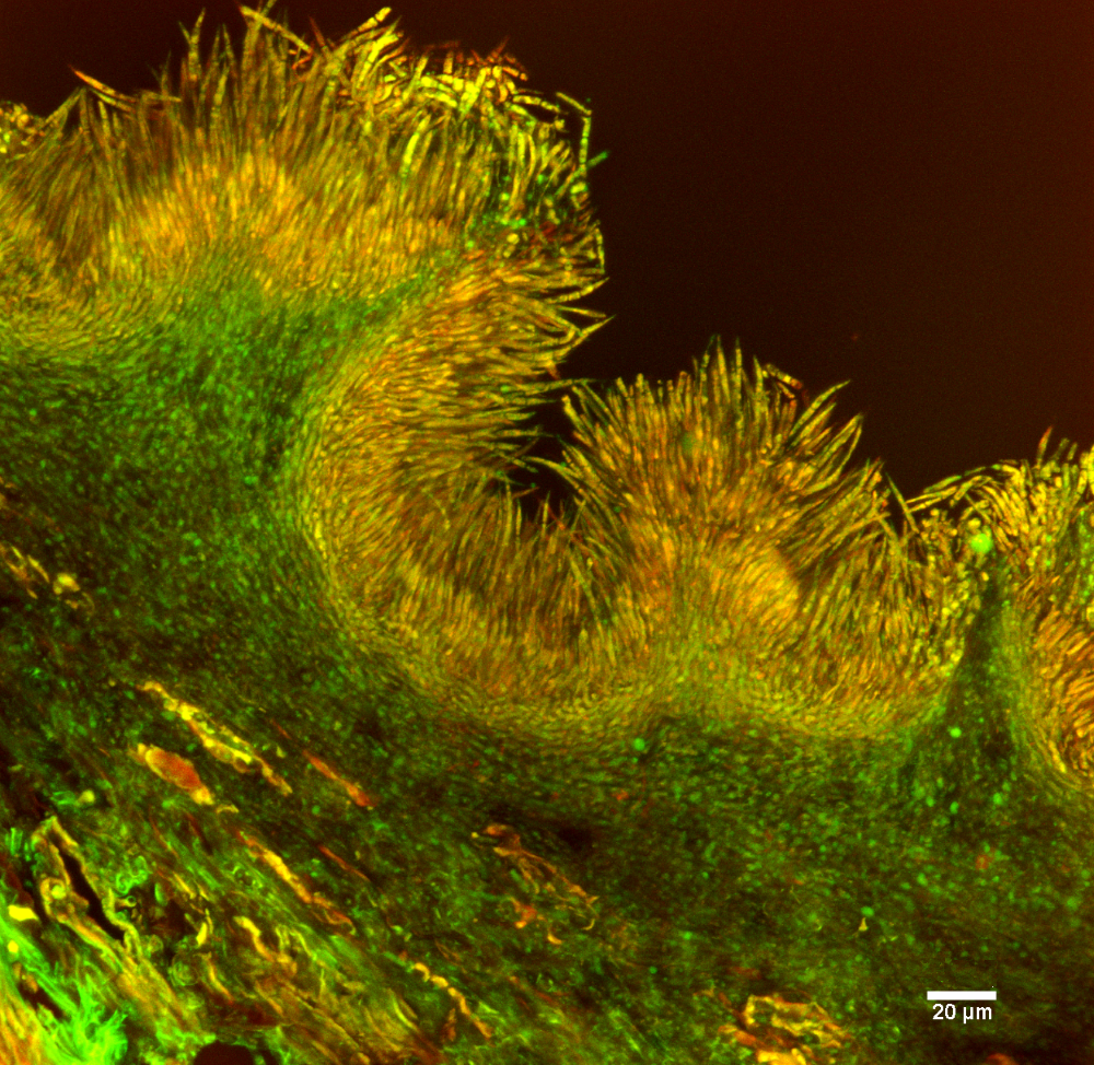 Pycnidia of Gremmeniella abietina lined with conidia colored in orange on this confocal microscopic image. 
