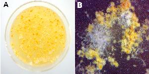 Gymnascella aurantiaca (A) Yellow-to-orange colony with individual and clusters of mostly naked asci, (B) Magnified portion of colony showing solitary and confluent clusters of asci loosely surrounded by vegetative hyphae.