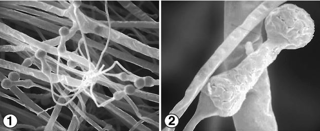 Figure 1) Multispored sporangia from a stolon of Halteromyces radiatus. Figure 2) H. radiatus dumbbell-shaped columellate sporangia. Images by Kerry O'Donnell.